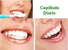 Dientes sanos y dentistas en Quito Ecuador